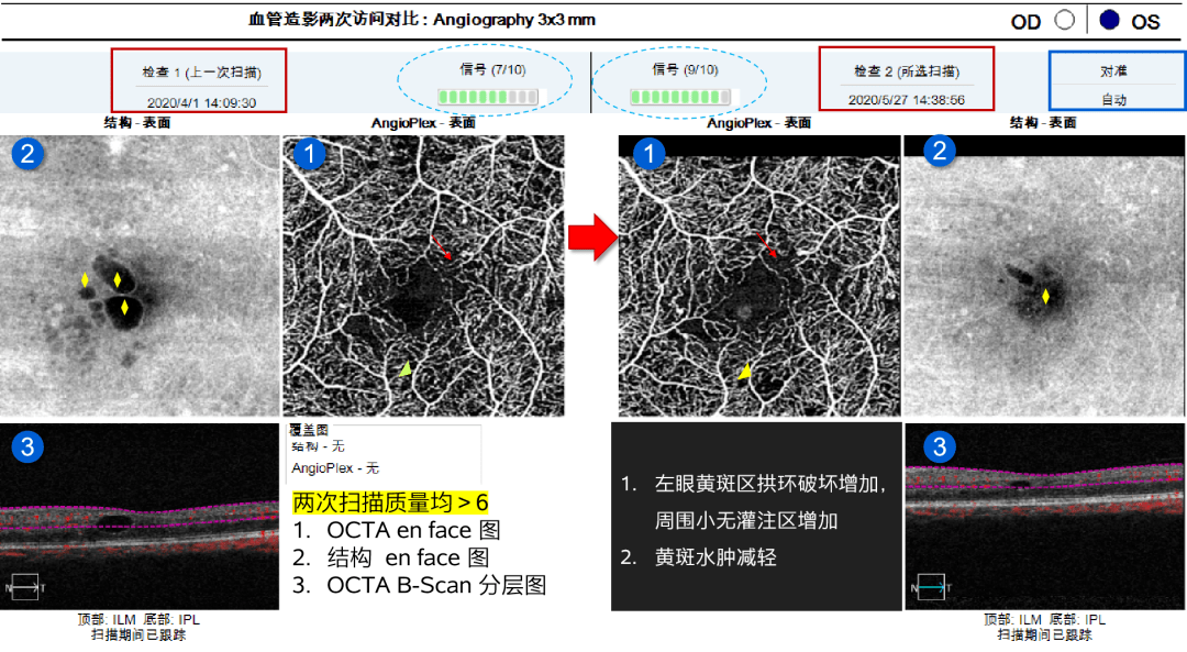 6iop的简单介绍